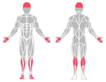 The infographic shows the cranium, hand, lower leg and foot were the main body areas injured.