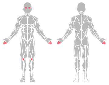 The infographic shows the finger, knee and eye were the main body areas injured.