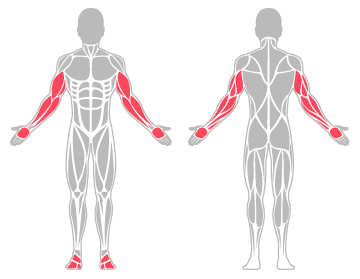 The infographic shows the forearm, upper arm, hand and foot were the main body areas injured.