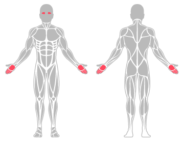 The infographic shows the fingers, eye, and hand were the main body areas injured.