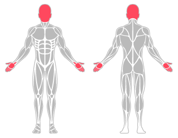 The infographic shows the brain, psychological system in general, hand, head and other and wrist were the main body areas injured