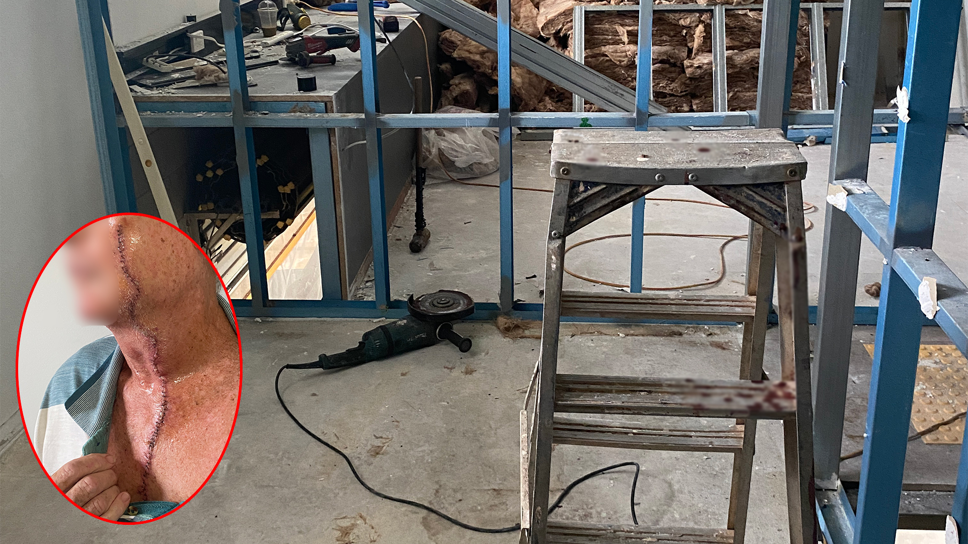 The image shows the incident scene in situ after the incident. To the right of the image, the steel wall frame is in view with a step ladder next to it. In the background, more of the steel wall frame is in view as well as the 9-inch grinder on the floor. The insert image shows the upper body of the injured worker showing his wound (which has been stitched) running from his cheek down his face, throat and to his sternum. A portion of the workers face has been blurred to protect his identity.
