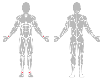The infographic shows ankle and wrist were the main body areas injured.