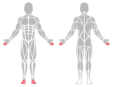 The infographic shows the fingers and foot were the main body areas injured.